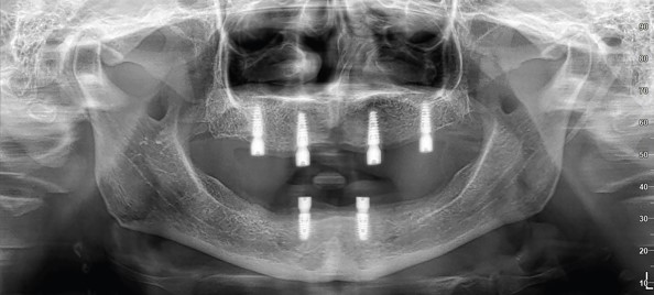 Curso de Kinesiología en el Paciente Quirúrgico Maxilofacial